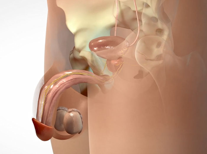 Erectile Dysfunction After Prostate Cancer | Hardfacts.co.nz